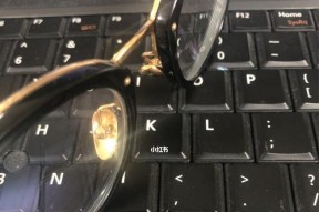 如何缓解长时间对着电脑眼睛疼痛（预防和治疗眼部疲劳的有效方法）