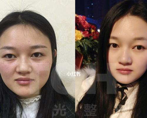 美颜相机无法去除斑点怎么办？调整哪些设置可以改善？  第3张
