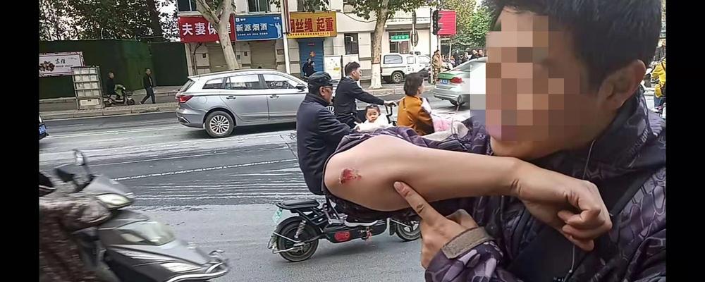 电瓶车擦伤汽车如何处理？处理步骤是什么？  第2张